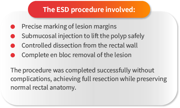 esd procedure